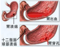 看胃病医院福州哪个好