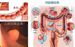 福州糜烂性胃炎治疗专业医院是哪家