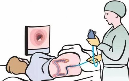 福州做肠镜哪个医院好